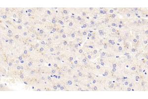 Detection of TSLP in Human Liver Tissue using Polyclonal Antibody to Thymic Stromal Lymphopoietin (TSLP) (Thymic Stromal Lymphopoietin antibody  (AA 29-159))