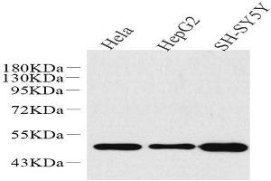 Western Blot analysis of various samples using GLUT-3 Polyclonal Antibody at dilution of 1:1000. (SLC2A3 antibody)