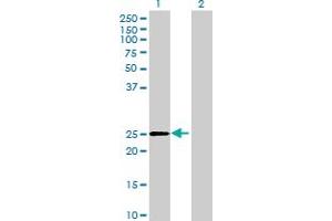 Western Blot analysis of DHRS4L2 expression in transfected 293T cell line by DHRS4L2 MaxPab polyclonal antibody.