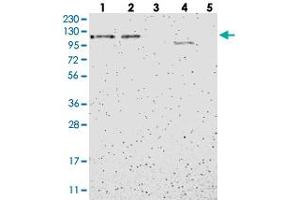 Western blot analysis of Lane 1: RT-4, Lane 2: U-251 MG, Lane 3: Human Plasma, Lane 4: Liver, Lane 5: Tonsil with B4GALNT3 polyclonal antibody . (B4GALNT3 antibody)