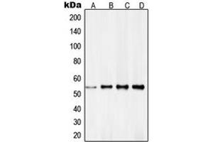Western blot analysis of RXR gamma expression in HeLa (A), NIH3T3 (B), MCF7 (C), A431 (D) whole cell lysates. (Retinoid X Receptor gamma antibody  (Center))