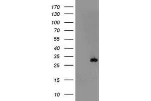 HEK293T cells were transfected with the pCMV6-ENTRY control (Left lane) or pCMV6-ENTRY PSMB4 (Right lane) cDNA for 48 hrs and lysed. (PSMB4 antibody)