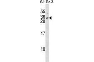 Western blot analysis in SK-BR-3 cell line lysates (35ug/lane) using Interleukin-28B  Antibody (N-term).