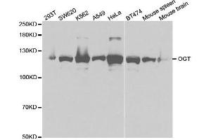 Western blot analysis of extracts of various cell lines, using OGT antibody.