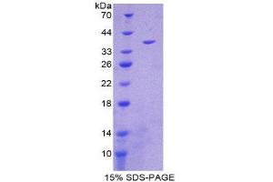 SDS-PAGE (SDS) image for Mitochondrially Encoded NADH Dehydrogenase 1 (MT-ND1) (AA 19-84) protein (His tag,GST tag) (ABIN2123343)