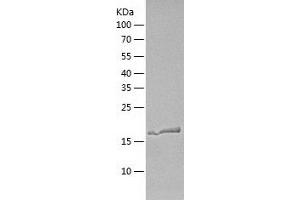 Western Blotting (WB) image for ADP Ribosylation Factor Like GTPase 1 (ARL1) (AA 1-181) protein (His tag) (ABIN7121728)