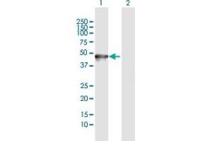 Western Blot analysis of KRT35 expression in transfected 293T cell line by KRT35 MaxPab polyclonal antibody. (Keratin 35 antibody  (AA 1-455))