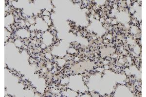 ABIN6273052 at 1/100 staining Mouse lung tissue by IHC-P. (LARP7 antibody  (C-Term))