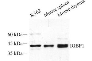 Western blot analysis of IGBP1 (ABIN7074276) at dilution of 1: 500