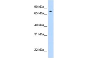 Western Blotting (WB) image for anti-Signal Transducer and Activator of Transcription 1, 91kDa (STAT1) antibody (ABIN2460706)