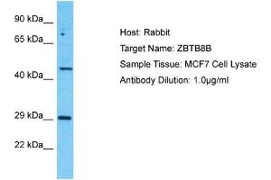 Host: Rabbit Target Name: ZBTB8B Sample Tissue: Human MCF7 Whole Cell Antibody Dilution: 1ug/ml (ZBTB8B antibody  (C-Term))