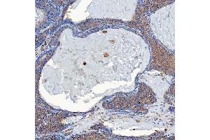 IHC analysis of SETD3 using anti-SETD3 antibody (ABIN7600293). (SETD3 antibody  (AA 173-468))