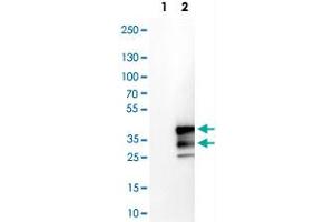 Western Blot analysis of Lane 1: negative control (vector only transfected HEK293T cell lysate) and Lane 2: over-expression lysate (co-expressed with a C-terminal myc-DDK tag in mammalian HEK293T cells) with VPS24 polyclonal antibody .