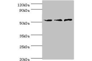 Western blot All lanes: ACVR1C antibody at 4 μg/mL Lane 1: Mouse brain tissue Lane 2: HepG2 whole cell lysate Lane 3: Hela whole cell lysate Secondary Goat polyclonal to rabbit IgG at 1/10000 dilution Predicted band size: 55, 38, 47, 50 kDa Observed band size: 55 kDa (ACVR1C/ALK7 antibody  (AA 22-113))