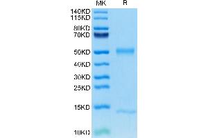 FcRn Protein (AA 22-297) (His tag)