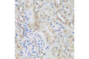 Immunohistochemistry of paraffin-embedded rat kidney using UBE3A antibody (ABIN5975332) at dilution of 1/200 (40x lens).