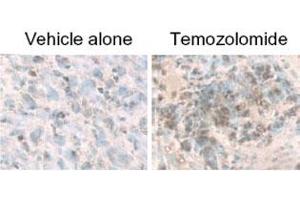 LC3B staining of MAP1LC3B in treated U87-MG cultured & subcutaneous tumors using MAP1LC3B polyclonal antibody . (LC3B antibody  (AA 1-50))