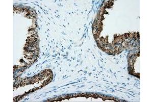 Immunohistochemical staining of paraffin-embedded liver tissue using anti-NME4 mouse monoclonal antibody. (NME4 antibody)