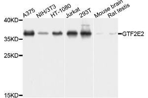Western blot analysis of extracts of various cells, using GTF2E2 antibody.