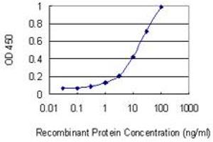 Detection limit for recombinant GST tagged SFTPA1 is 0. (Surfactant Protein A1 antibody  (AA 83-199))