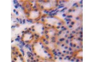 IHC-P analysis of Kidney tissue, with DAB staining. (CTGF antibody  (AA 25-348))