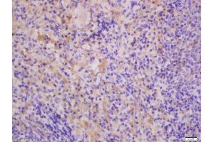Formalin-fixed and paraffin embedded Rat lung spleen labeled with Anti-THEMIS Polyclonal Antibody, Unconjugated  at 1:300, followed by conjugation to the secondary antibody and DAB staining. (THEMIS antibody  (AA 301-400))