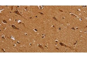 Immunohistochemistry of paraffin-embedded Human brain using NDUFS5 Polyclonal Antibody at dilution of 1:50 (NDUFS5 antibody)