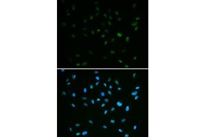 Immunofluorescence analysis of A549 cells using MSH6 antibody (ABIN5971626). (MSH6 antibody)