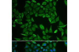 Immunofluorescence analysis of HeLa cells using CLPS Polyclonal Antibody