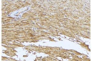 ABIN6273543 at 1/100 staining Mouse muscle tissue by IHC-P. (MRCKG antibody  (C-Term))