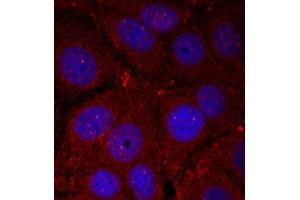Immunofluorescence staining of methanol-fixed Hela cells using Phospho-SNCA-Y136 antibody.