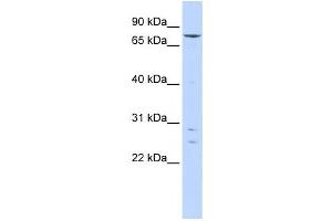 Western Blotting (WB) image for anti-Kelch-Like 4 (KLHL4) antibody (ABIN2458392) (Kelch-Like 4 antibody)