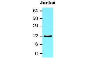The lysates of Jurkat (20 ug) were resolved by SDS-PAGE, transferred to nitrocellulose membrane and probed with anti-human BID (1:1000).