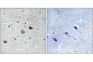 Immunohistochemistry analysis of paraffin-embedded human brain, using CaMK2-beta/gamma/delta (Phospho-Thr287) Antibody. (CaMK2 beta/gamma/delta (AA 253-302), (pThr287) antibody)