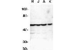 Western blot analysis of Caspase-10 in HeLa (H), Jurkat (J), A431 (A), K562 (K) whole cell lysates with Caspase-10 antibody at 1μg/ml. (Caspase 10 antibody  (C-Term))