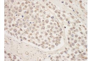 Immunohistochemistry (IHC) image for anti-SRSF Protein Kinase 1 (SRPK1) (AA 275-325) antibody (ABIN7453793)