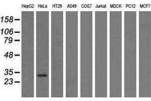 Western blot analysis of extracts (35 µg) from 9 different cell lines by using anti-GSTT2 monoclonal antibody. (GSTT2 antibody)