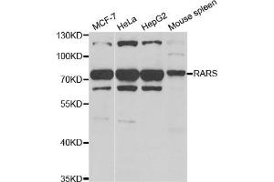 Western Blotting (WB) image for anti-Arginyl-tRNA Synthetase (RARS) antibody (ABIN1980323) (RARS antibody)