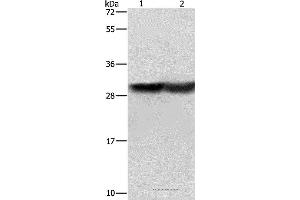 Western blot analysis of Human fetal brain and mouse kidney tissue, using CALB1 Polyclonal Antibody at dilution of 1:600 (CALB1 antibody)