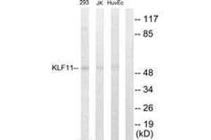 Western blot analysis of extracts from 293/Jurkat/HuvEc cells, using KLF11 Antibody.