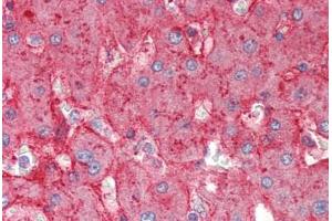 Human Liver (formalin-fixed, paraffin-embedded) stained with APOE antibody ABIN337117 at 2. (APOE antibody  (AA 305-317))