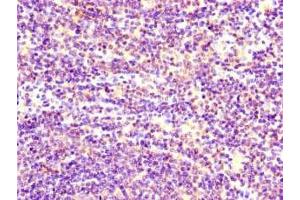 Immunohistochemistry of paraffin-embedded human lymph node tissue using ABIN7170833 at dilution of 1:100 (STIM1 antibody  (AA 2-350))