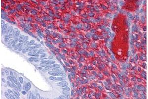 Immunohistochemistry (Formalin-fixed Paraffin-embedded Sections) (IHC (fp)) image for anti-Cadherin 18, Type 2 (CDH18) (AA 467-577) antibody (ABIN574223)