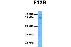 Host:  Rabbit  Target Name:  F13B  Sample Tissue:  Human DLD1  Antibody Dilution:  1. (F13B antibody  (Middle Region))