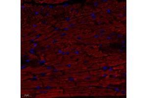 Immunofluorescence of paraffin embedded mouse heart using ATP5A1 (ABIN7073141) at dilution of 1: 300 (400x lens) (ATP5G1 antibody)