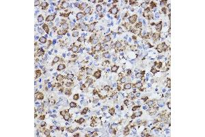 Immunohistochemistry of paraffin-embedded rat ovary using Erlin-2 Rabbit mAb (ABIN7267006) at dilution of 1:100 (40x lens). (ERLIN2 antibody)