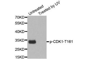 Western Blotting (WB) image for anti-Cyclin-Dependent Kinase 1 (CDK1) (pTyr15) antibody (ABIN1870049) (CDK1 antibody  (pTyr15))