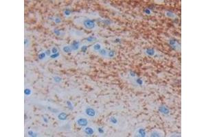 Figure. (Phosphoglucomutase 5 antibody  (AA 182-296))
