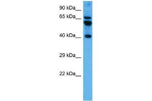 Host:  Mouse  Target Name:  PARD6B  Sample Tissue:  Mouse Brain  Antibody Dilution:  1ug/ml (PARD6B antibody  (N-Term))