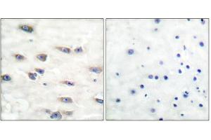 Immunohistochemical analysis of paraffin-embedded human brain tissue, using Trk A (phospho-Tyr791) antibody (left)or the same antibody preincubated with blocking peptide (right). (TRKA antibody  (pTyr791))